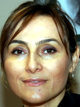 Op. Dr. Aysun  Baltacı