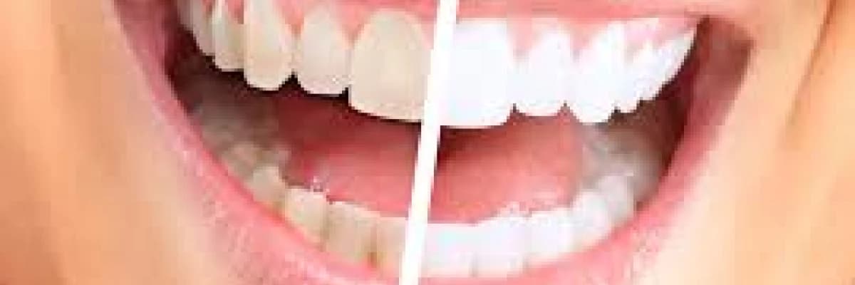 Pratik diş beyazlatma tavsiyeleri