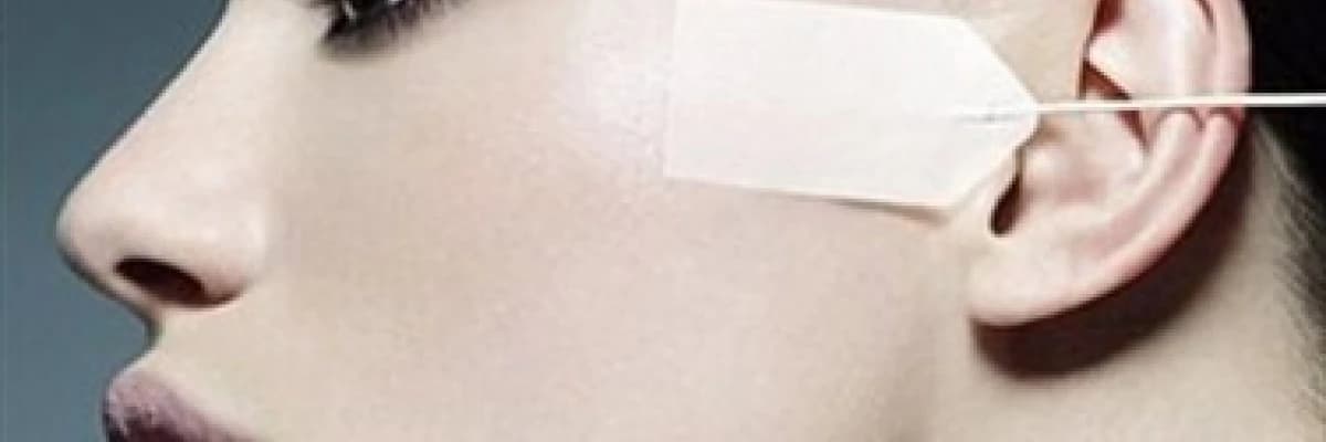 Yüz estetiği yüz germe (rhytidectomy)