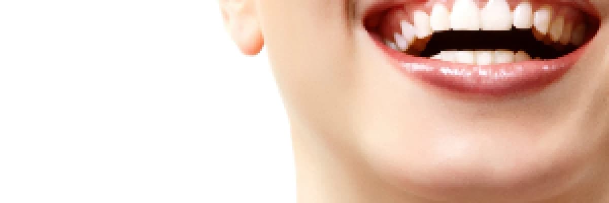 En iyi diş beyazlatma işlemi hangisidir?