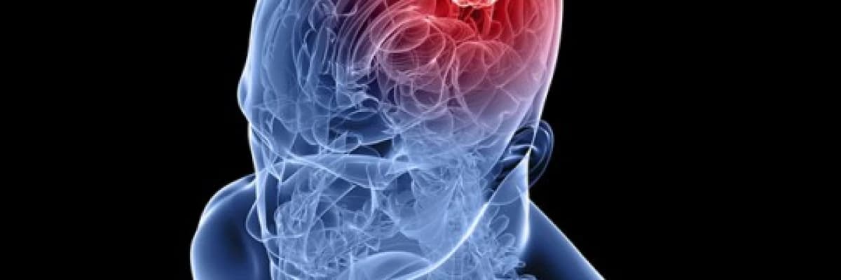 Beyin tümörleri kimlerde daha çok görülür?