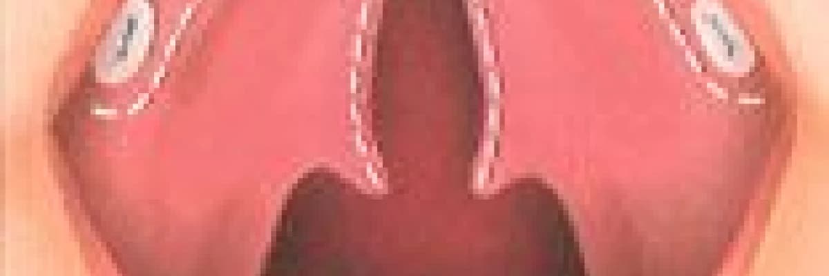 Yüz gelişimi anomalileri