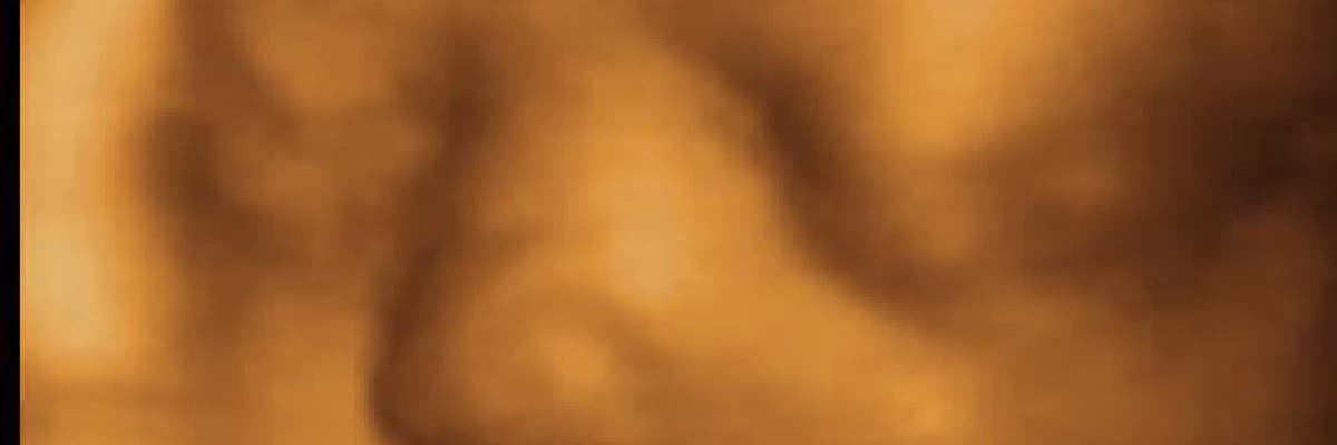 Dört boyutlu renkli ultrasonografi