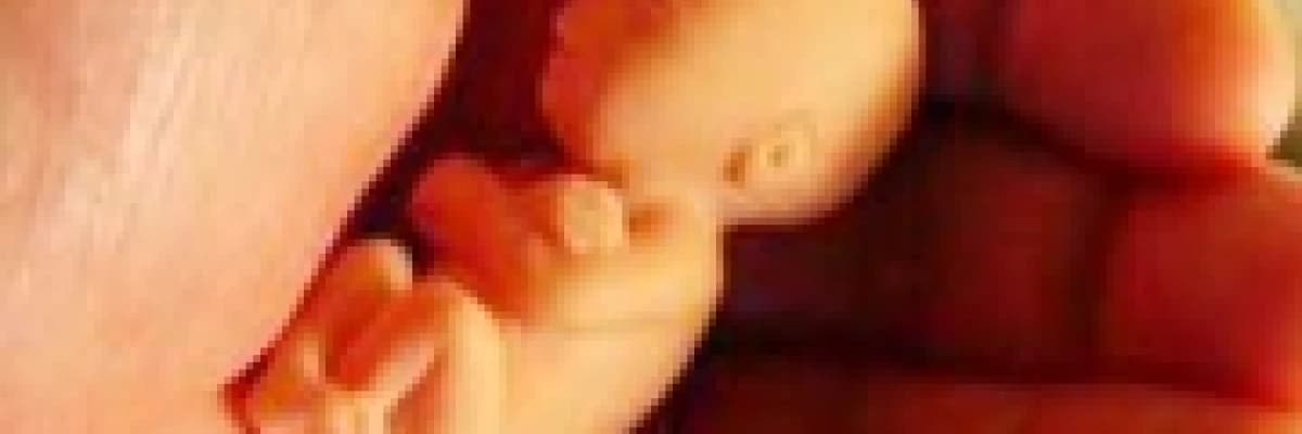 Düşük, anneye ve babaya ait nedenler!