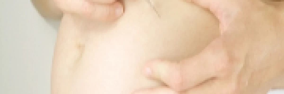 Hamilelikte şeker hastalığı (gestasyonel diabet)