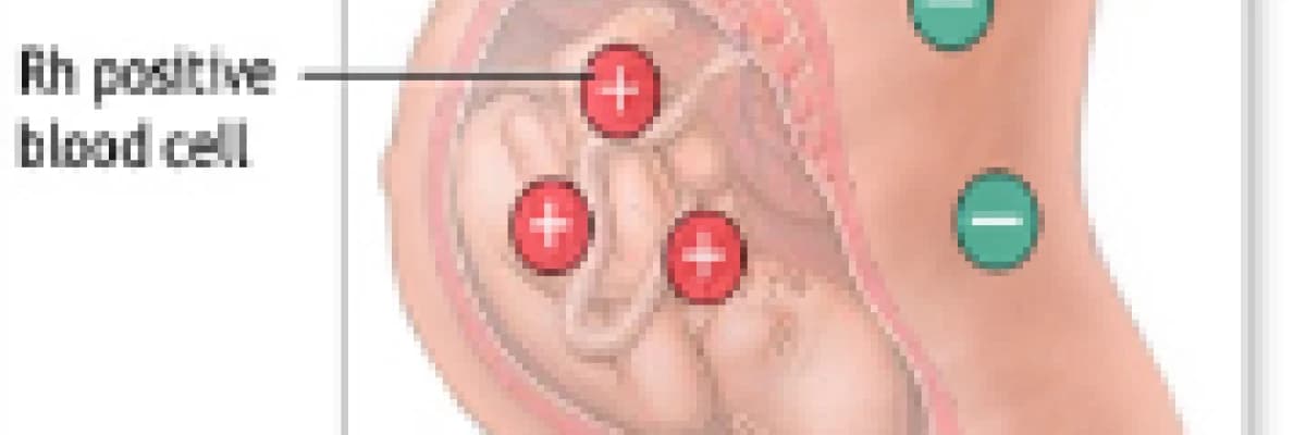 Rh negatif kadınların gebelikleri