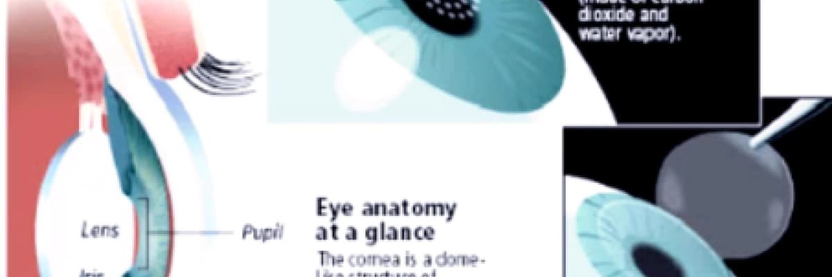 Refraktif göz cerrahisi nedir?