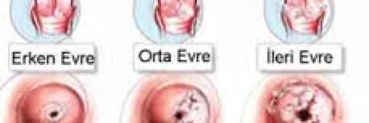 Serviks Kanseri, Tanısı, Tedavisi, Aşı ile Korunması Nasıldır?