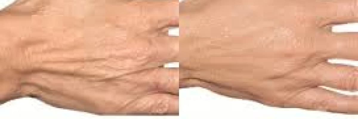 ELLERİNİZ YAŞINIZI ELE VERMESİN