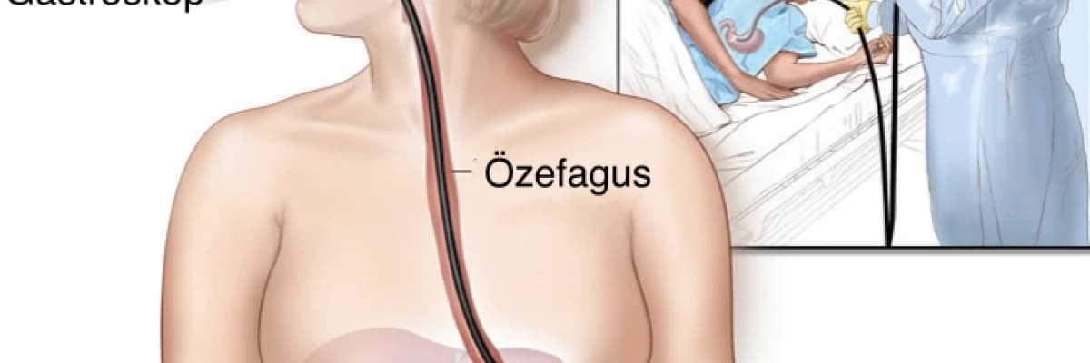 Gastroskopi işlem riskleri