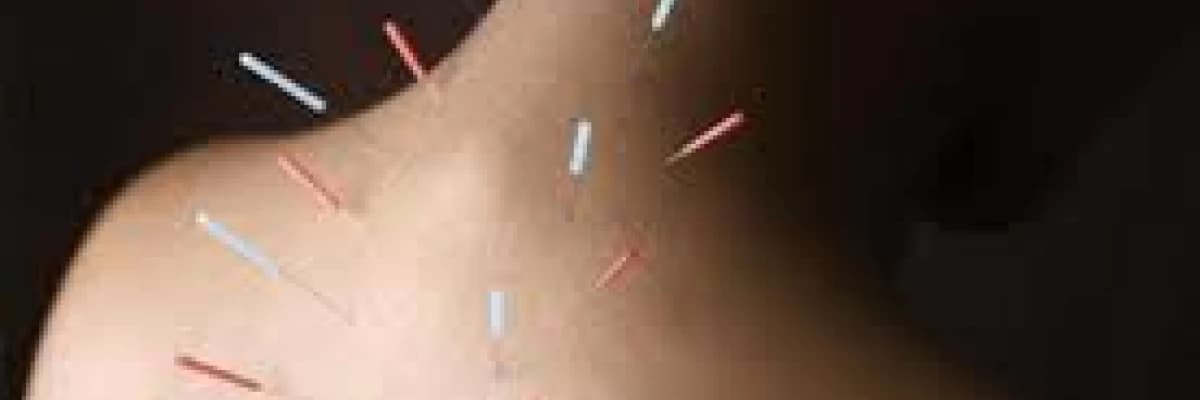 Akupunktur, akupunktur noktalarının özellikleri