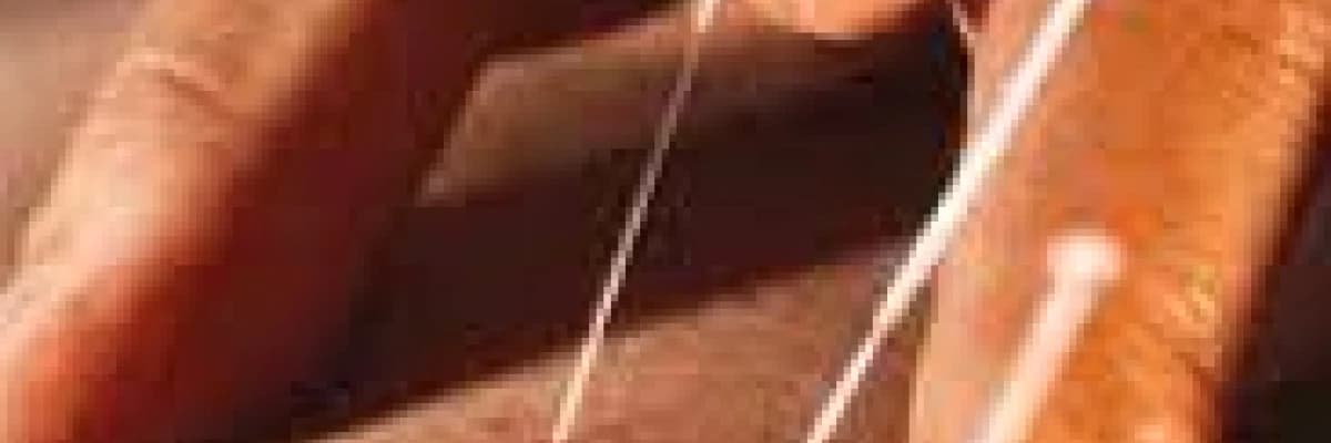 AKUPUNKTUR İLE TEDAVİ