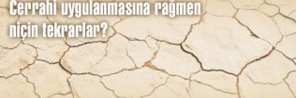 Anal fissür (çatlak) tedavisinde yeni tedavi yöntemleri