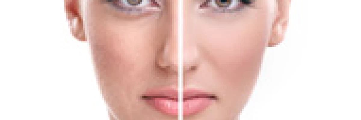 Cilt Bakımı ( Aletli, Kozmetik ve Medikal)