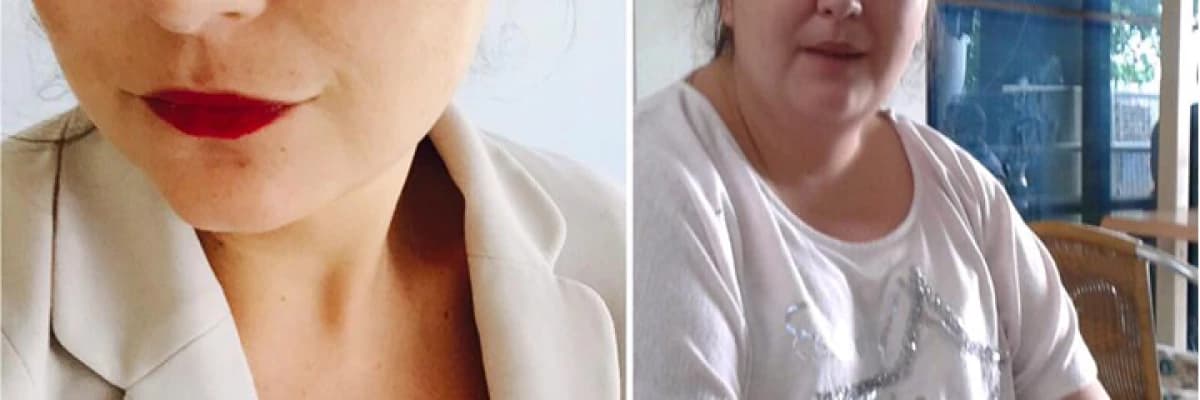 OBEZİTE VE HİPERTANSİYON