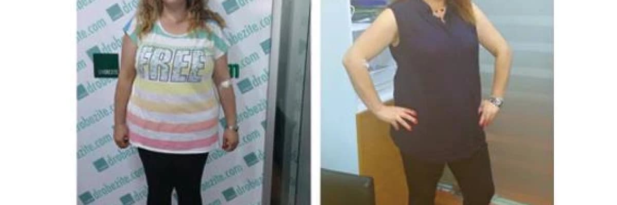 Obezitenin Yol Açtığı Kanser Türleri Nelerdir?