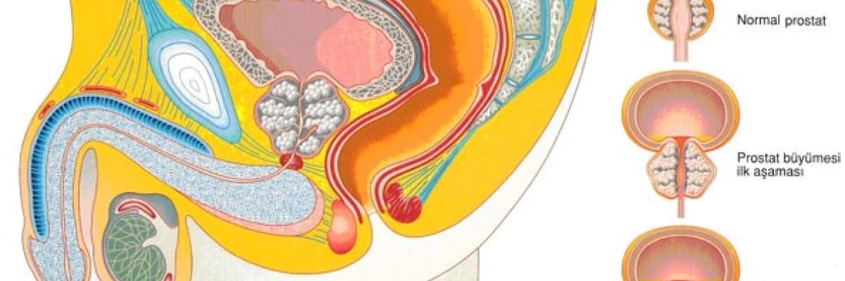 PROSTAT NEDİR? NEREDE BULUNUR? NE YAPAR?
