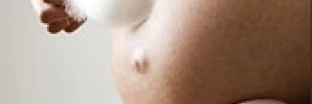 Tüylenme ve Polikistik Over Vendromunu