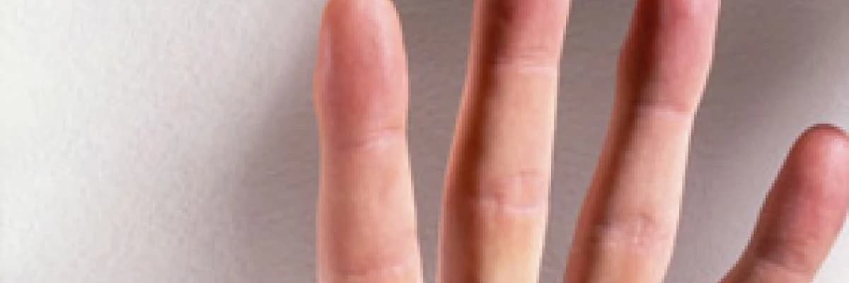 Vajinismusta Parmak Egzersizlerı