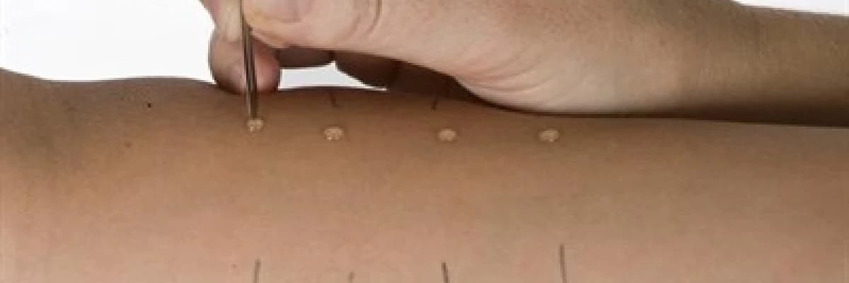 Allerji testleri hangi durumlarda ve nasıl uygulanır?