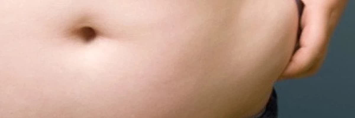 Sorularla şişmanlık hastalığı hakkında genel bilgiler