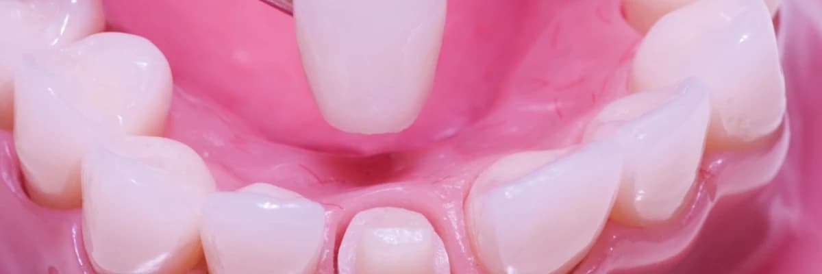 Kaybolan Diş Ağrılarının Gizemi