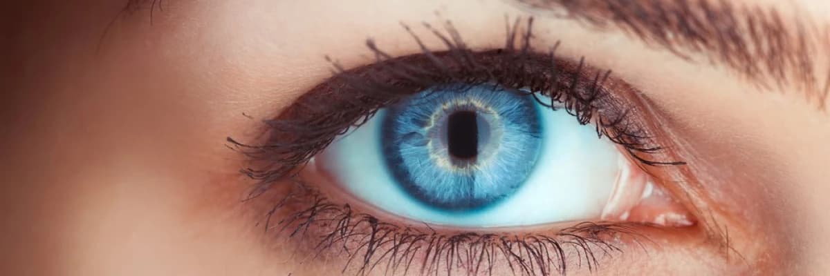 GÖZ SEĞİRMESİ NEDİR? NEDEN OLUR?