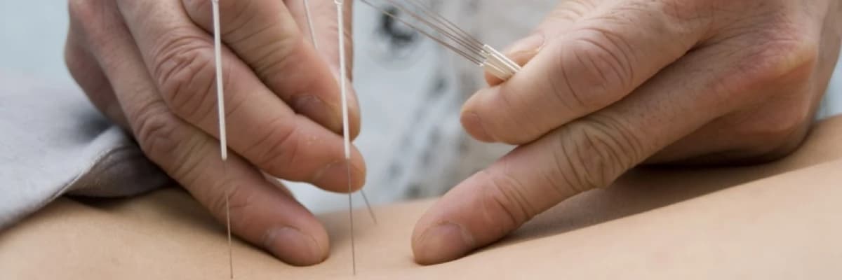 AKUPUNKTUR; MUTLU, HUZURLU, SAĞLIKLI BİR YAŞAM İÇİN.