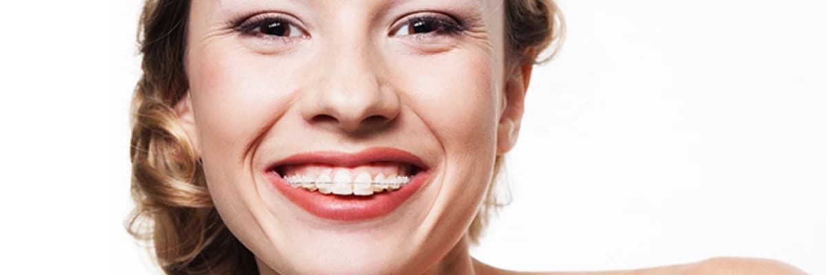 Ortodontik Tedavilerde  Estetik Yaklaşımlar