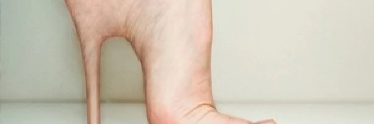 Topuklu giymenin zararları