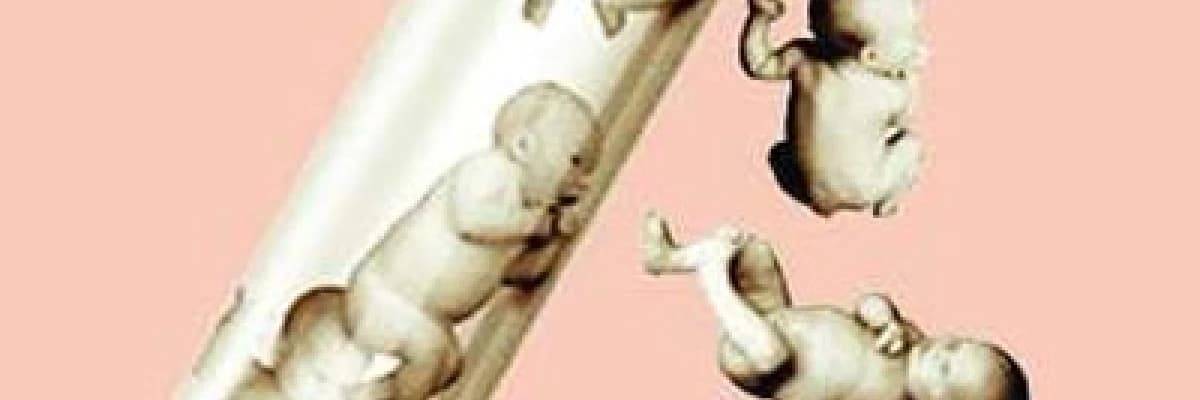 TÜP BEBEK TEDAVİLERİ