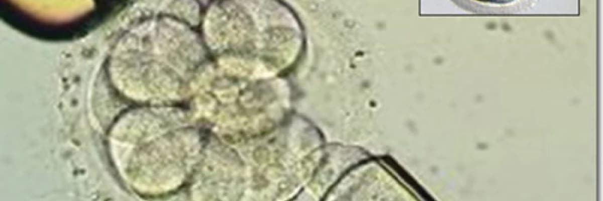 TÜP BEBEK VE BAŞARI