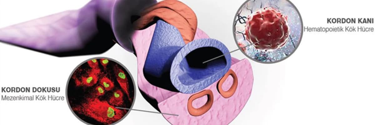 Kordon kanı saklanması hakkında neler biliyoruz?
