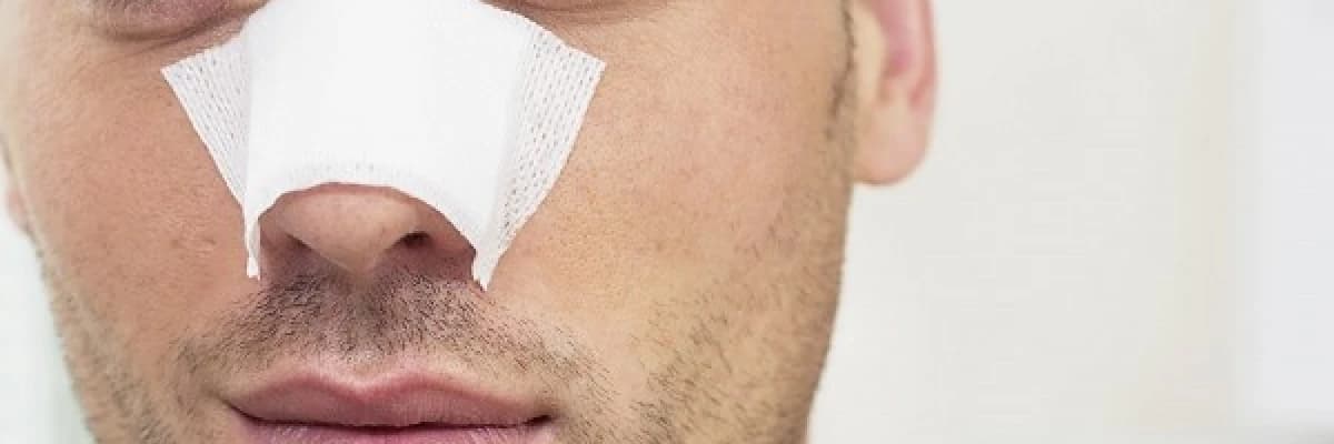 Erkekler İçin Burun Estetiği! Dikkat edilmesi gerekenler nelerdir?