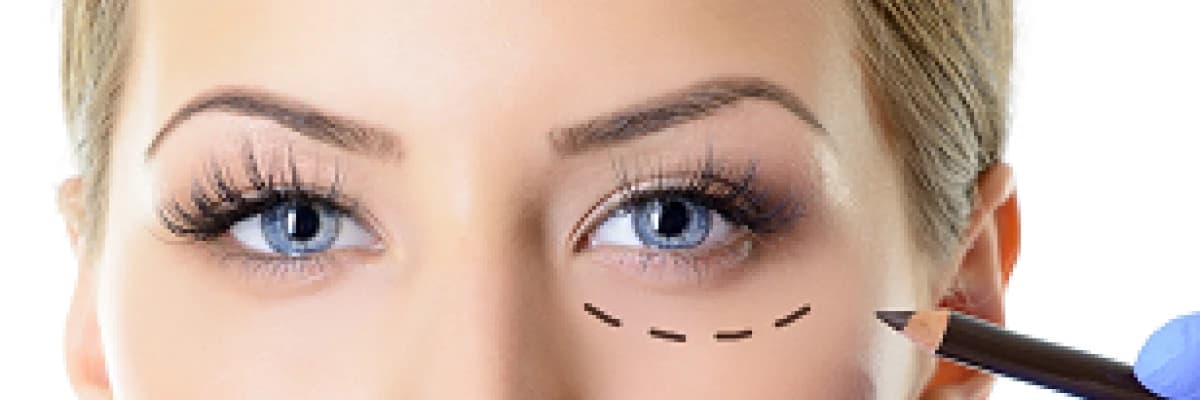 Göz Çevresi Estetiği (Bleferoplasti)