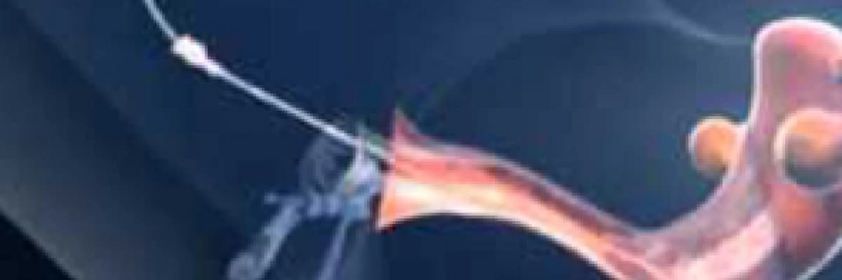 Aşılama - IUI neden yapılır ?