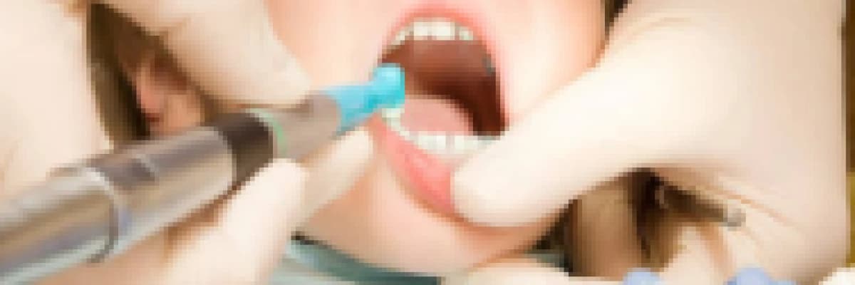 Fluor Uygulaması Nasıl ve Ne Zaman Yapılır?