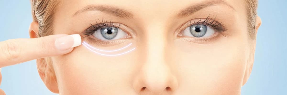 Gözaltı Işık Dolgusu