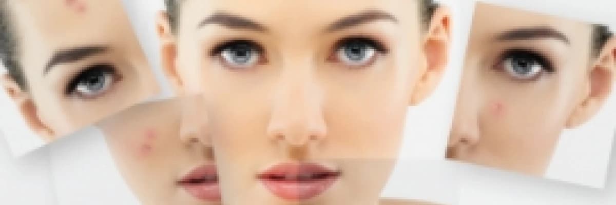 Behçet Hastalığı Tanı, Teşhis ve Tedavisi