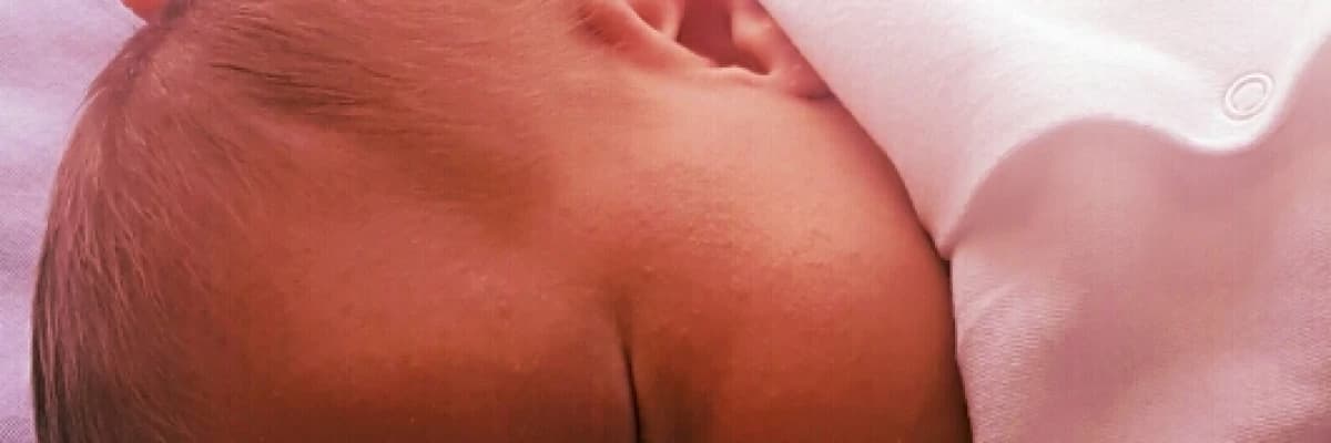 Yenidoğan sünneti yararlı mıdır?