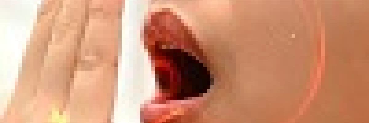 Ağız kokusu nedeni?