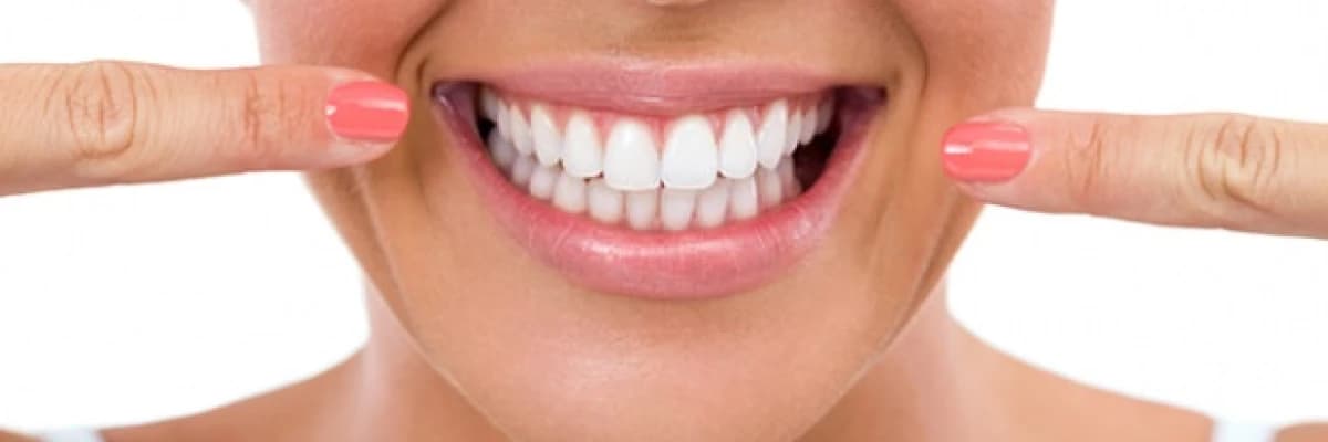 Diş Beyazlatma (Bleaching) ile ilgili en çok sorulan sorular