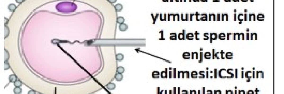 Tüp Bebek (IVF: In Vitro Fertilizasyon)