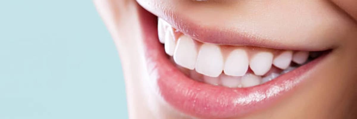 Gülümseme estetiği