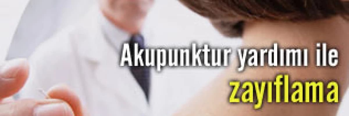 Akupunktur yardımı ile zayıflama