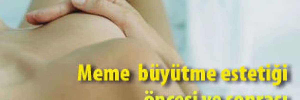 Meme  büyütme estetiği öncesi ve sonrası