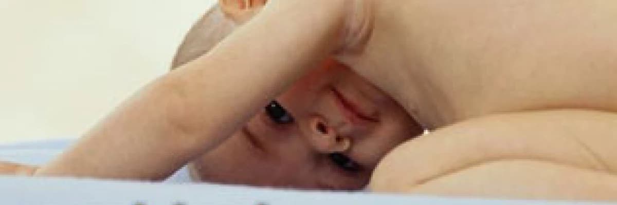 Yarık dudak ve yarık damak