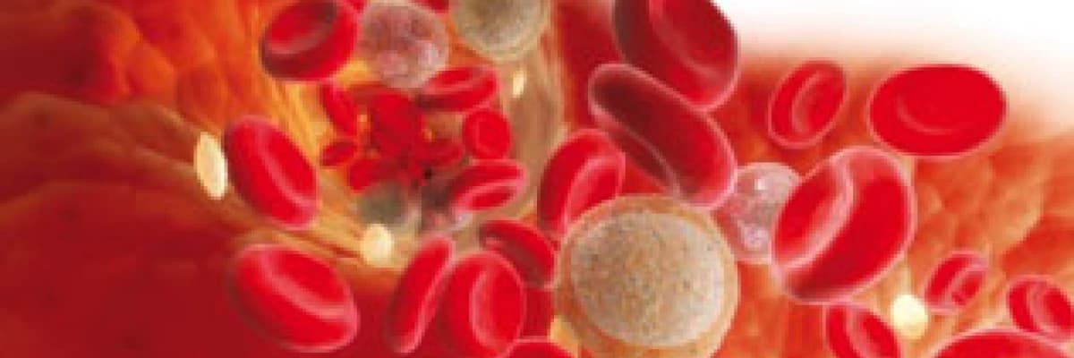 Derin ven trombozu (dvt) hakkında bilmemiz gerekenler