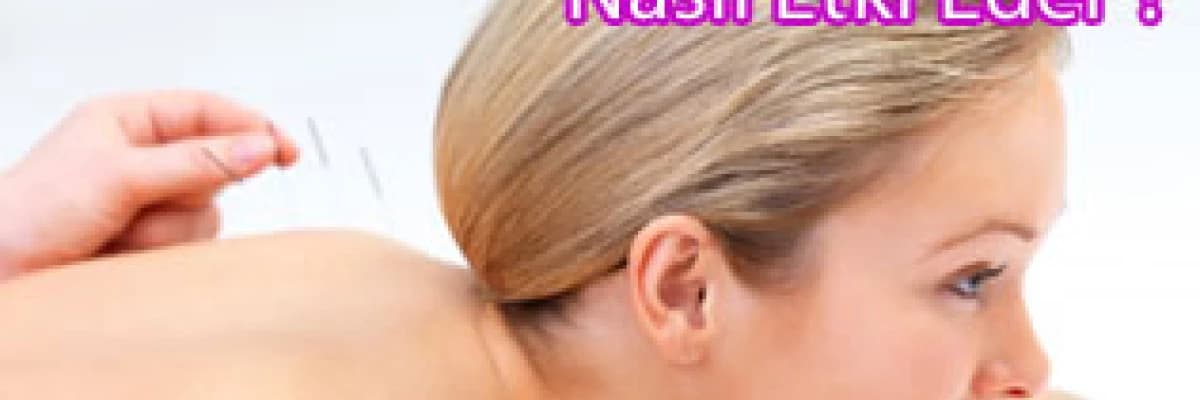 Akupunktur nasıl etki eder ?