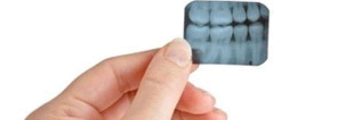 Değişim dişlerde başlar